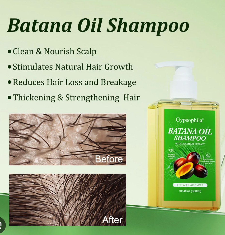 💆🏻♀️¡NUEVO! SHAMPOO Y ACEITE DE BATANA Evita la Caída y Obtén un Crecimiento de Cabello abundante