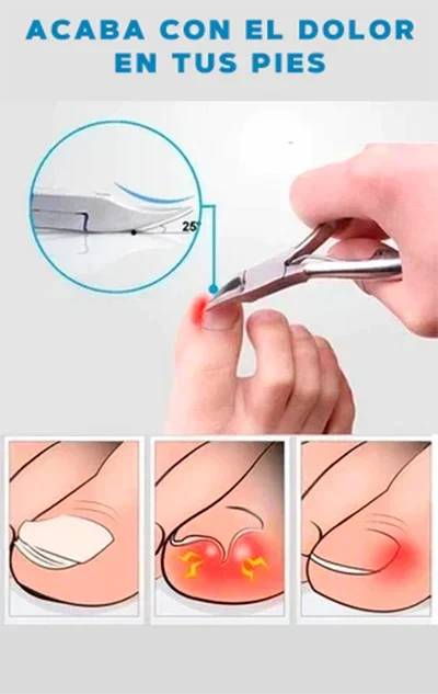 CORTAUÑAS DE GRADO MÉDICO - NAILCLIPPER™