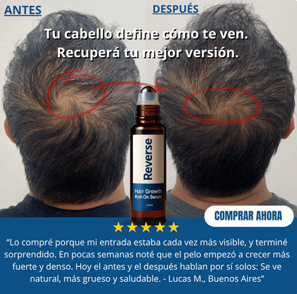 3X1 ✅Serum Roll-On para el Crecimiento Capilar - Reverse