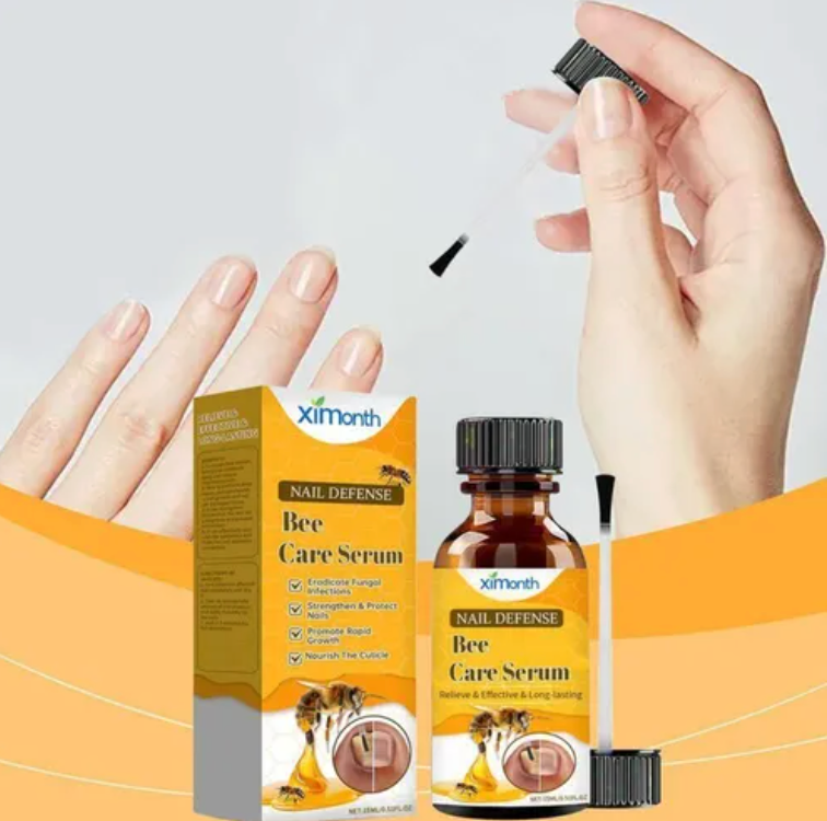 ToenailPlus™ - Elimina los hongos de raíz | Paga 1 lleva 2