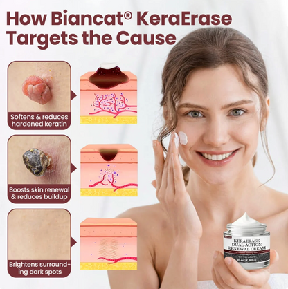 Crema renovadora de doble acción Biancat® KeraErase