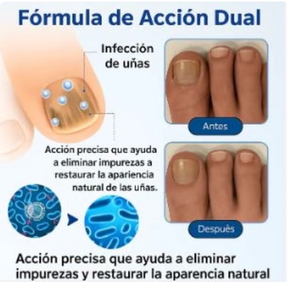 Elimina la infección de tus uñas por el hongo, irregularidades, coloración amarillenta y fractura🔥