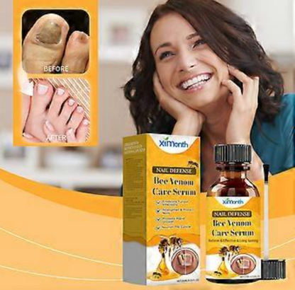 ToenailPlus™ - Elimina los hongos de raíz | Paga 1 lleva 2
