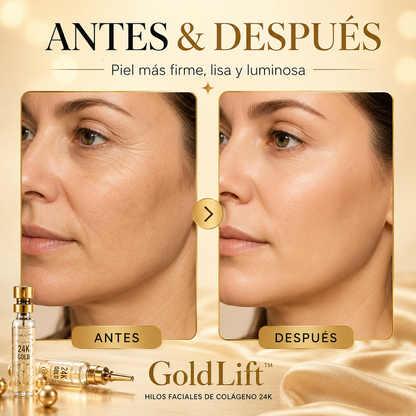 GoldLift™ – Hilos Faciales de Colágeno 24K ✨