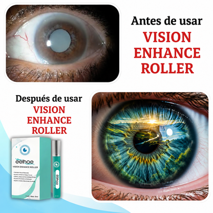 Vision Enhance Roller – Alivio para Ojos Cansados