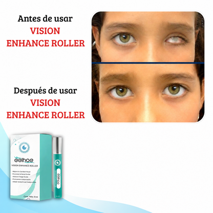 Vision Enhance Roller – Alivio para Ojos Cansados