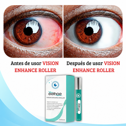 Vision Enhance Roller – Alivio para Ojos Cansados