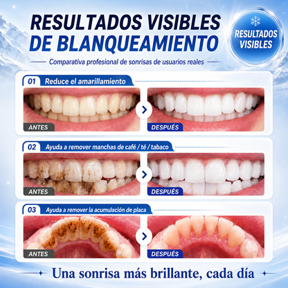 DentGlow™ – Espuma Dental Iluminadora