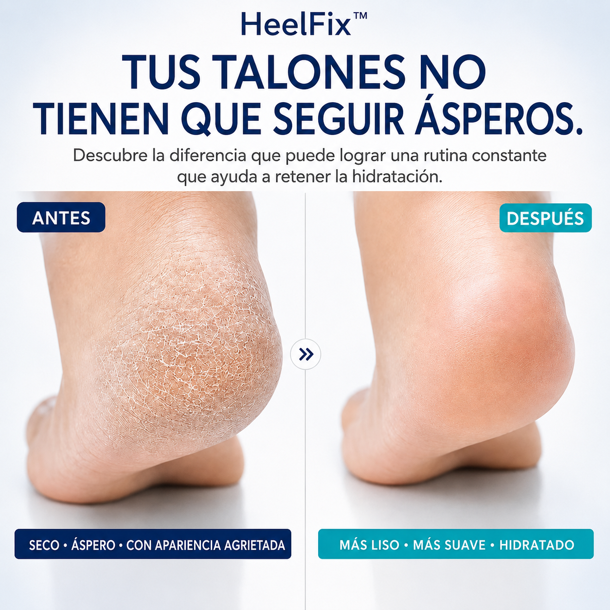 HeelFix™ – Crema Intensiva para Talones Secos y Ásperos